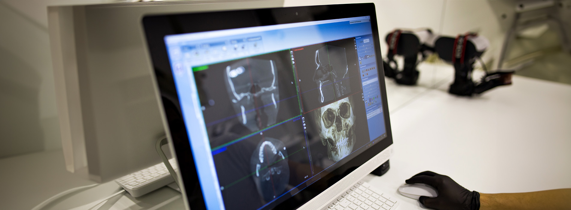 An X-ray displayed on a laptop screen next to a real human skull.