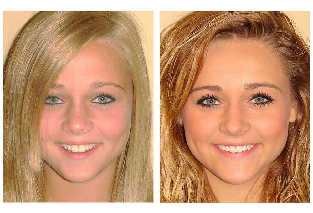 Riverbend Family Dental